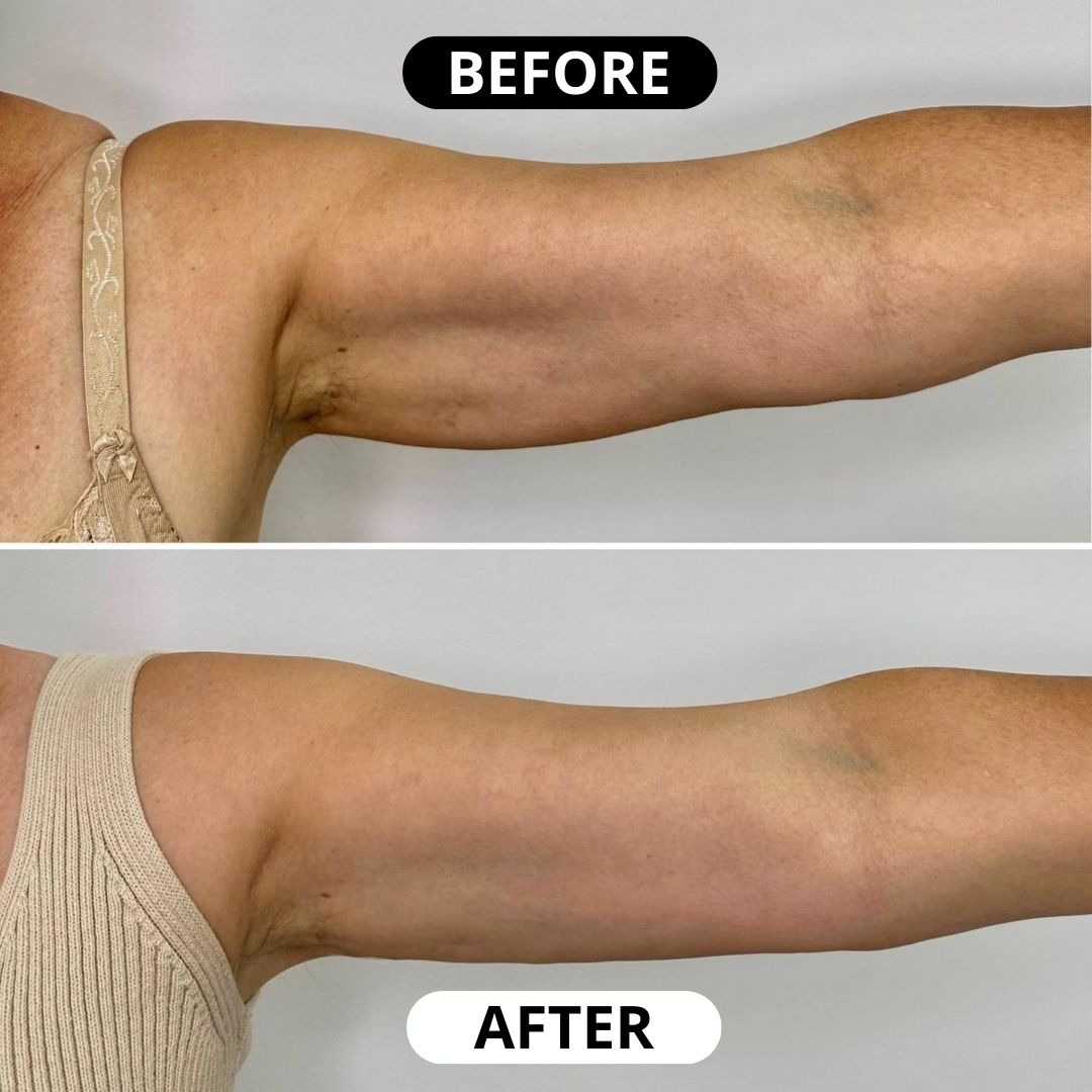 Lifting Body Oil: Crepey skin? Fine lines? It’s time to glow again.