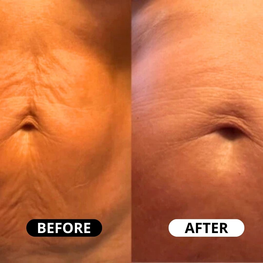 Lifting Body Oil: Crepey skin? Fine lines? It’s time to glow again.