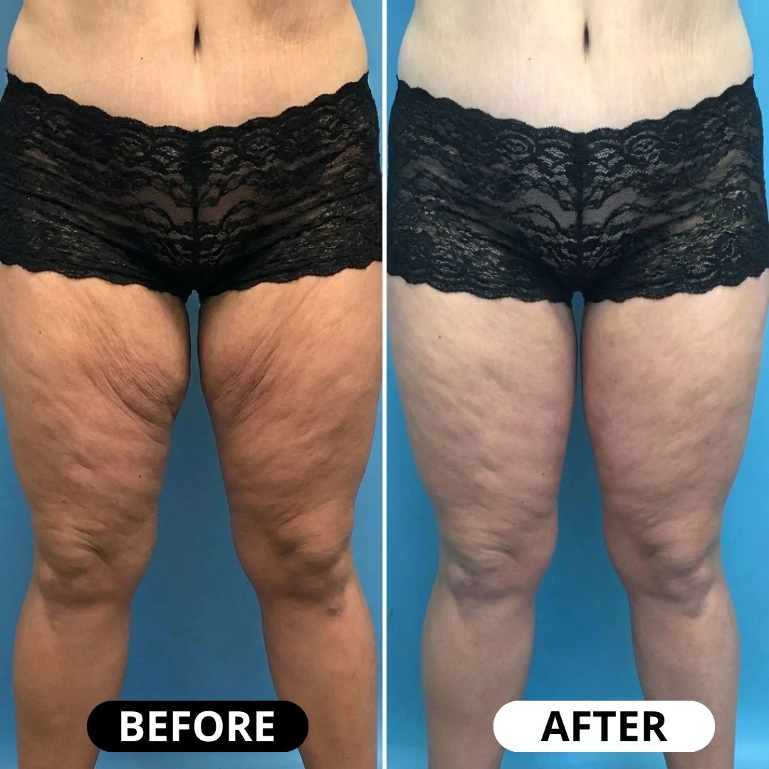 Lifting Body Oil: Crepey skin? Fine lines? It’s time to glow again.