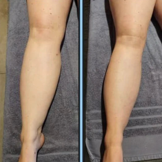 Lymphatic Drainage Elixir Olya™