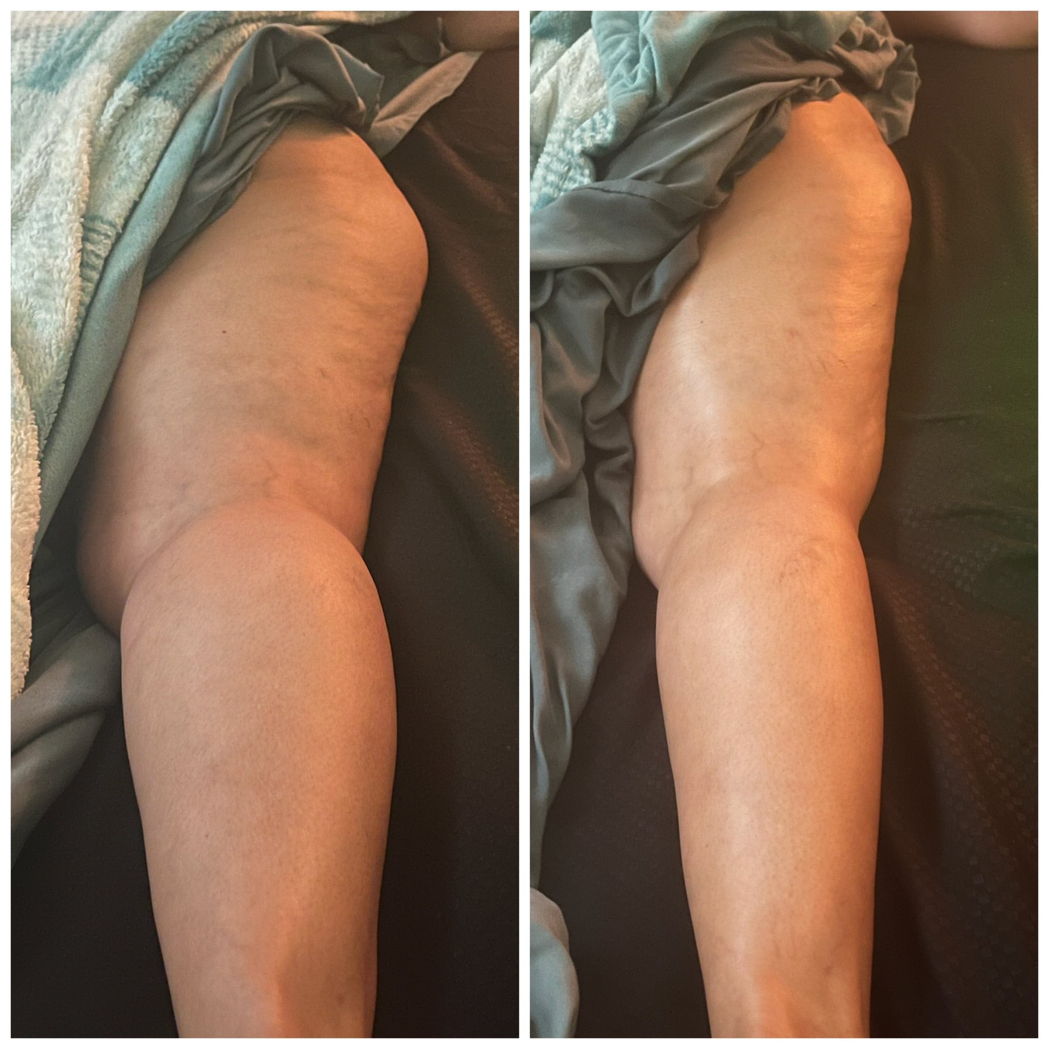 Lymphatic Drainage Elixir Olya™