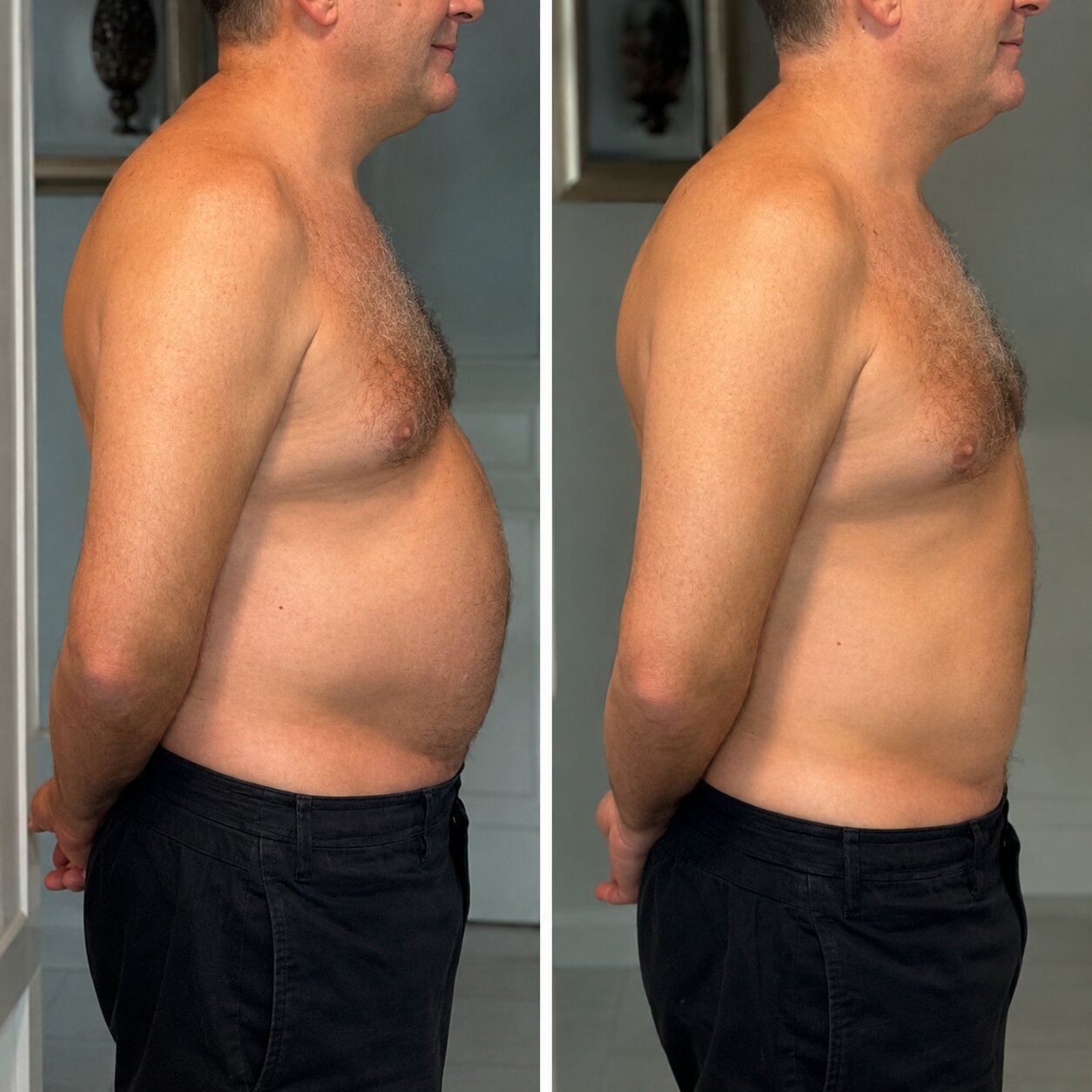 Drainage & Debloat Booster™